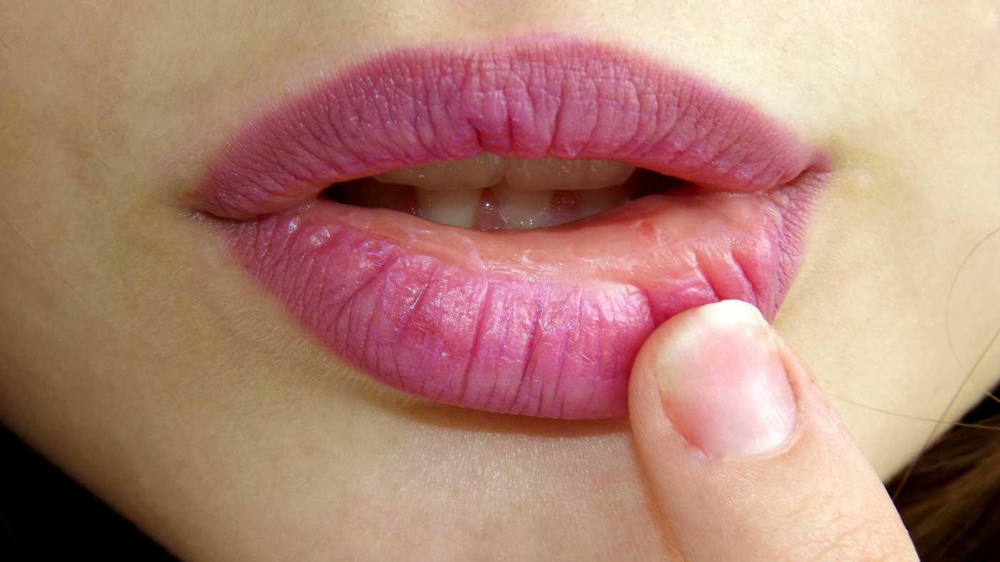 spr-de-lippen-trockene-lippen-was-tun-10-hausmittel